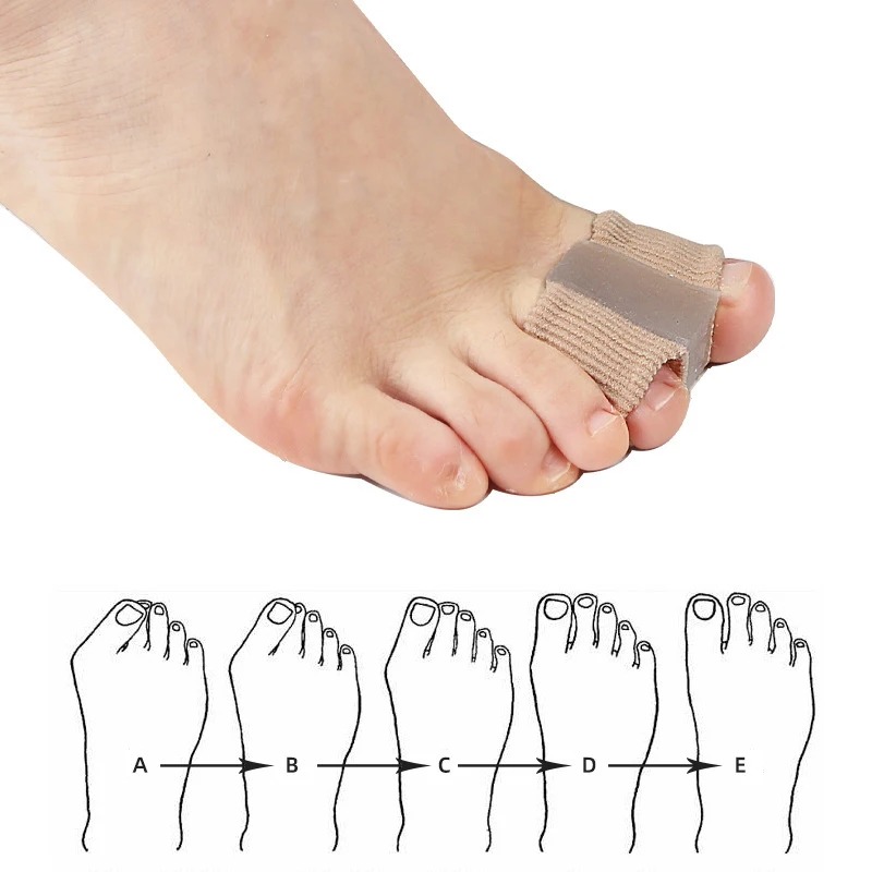 4 adet silikon ayak parmağı ay - Yoga Toe Separator incelemesi ve fiyatı