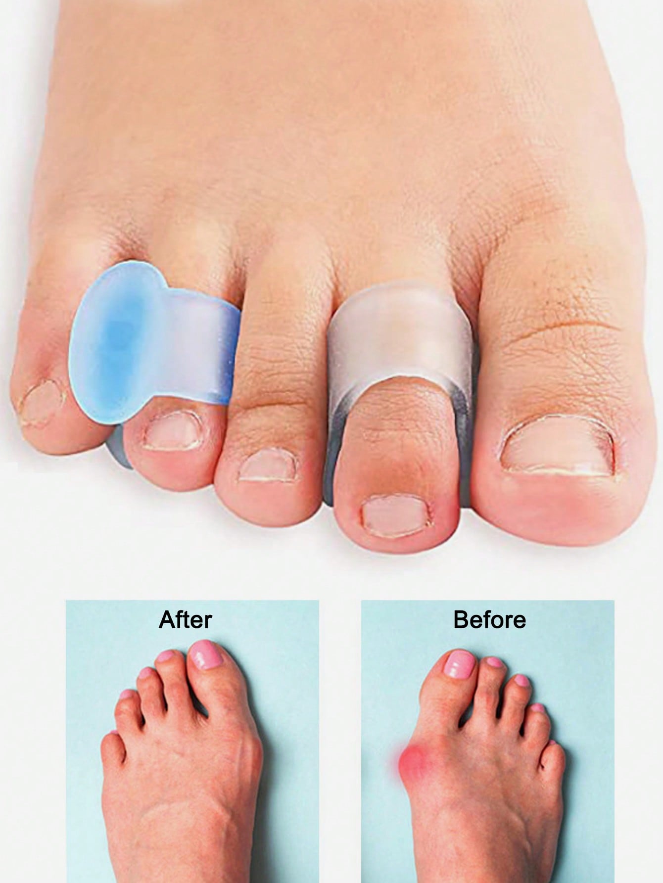 Jel Ayak Parmak Ayırıcı, Bunyo - Yoga Toe Separator incelemesi ve fiyatı